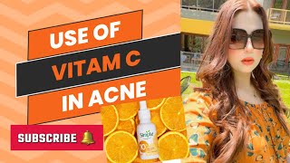 Should we use Vitamin C serums in active acne  کیا ایکنا والی جلد پر وٹامن c لگانا چاہے ؟ [upl. by Aicillyhp810]