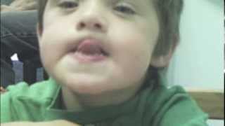 Dariens Journey with Childhood Apraxia of Speech [upl. by Kevyn]