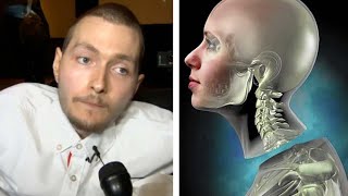 What Happened To The First Human Head Transplant Feat Medlife Crisis [upl. by Nairehs]