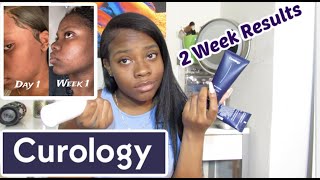 Curology Review  ON DARK SKIN [upl. by Liesa349]