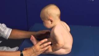 6 Month Old Babies in Pull to Sit Movement Typical and Atypical Development Comparison [upl. by Sueaddaht]