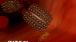 Nanobots Flowing Through a Blood Vessel [upl. by Krystyna]