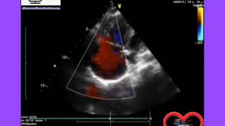 Ultrasound Board Review on Echocardiography [upl. by Charline]