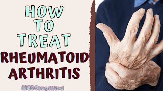 HOW TO TREAT RHEUMATOID ARTHIRITIS RA Signs and Symptoms and Management [upl. by Enia]