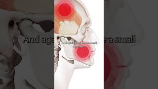 Temporalis Muscle Trigger Points [upl. by Ahtar677]