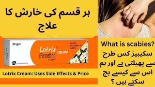 Lotrix cream  Perminthin  Use for Scabies  Treatment  Cream Side effects in Urdu Hindi [upl. by Helmer]