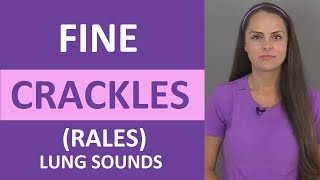 Fine Crackles Rales Lung Sound Causes Breath Sounds Audio Nursing [upl. by Odette]