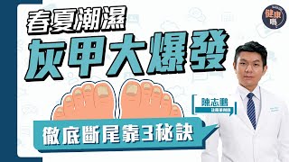 健身美甲暗藏灰甲陷阱？3秘訣徹底斷尾｜近半人灰甲復發 全因選錯產品？｜註冊藥劑師拆解 治灰甲偏方迷思｜健康嗎HealthCodeHK 【Chat醫D】onychomycosis [upl. by Derej]