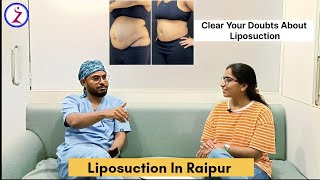 Liposuction in Raipur  Liposuction Surgery Cost in Raipur  Zenith Clinic [upl. by Anegroeg592]