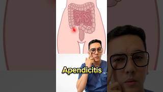 Síntomas de alerta de apendicitis que no debes ignorar  Dr William Guerrero medicina shorts [upl. by Tawsha]