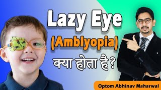 What is Amblyopia Lazy Eye  Lazy Eye Treatment  What is Amblyopia  Lazy Eye Exercise [upl. by Meriel]