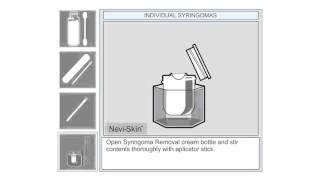 Individual Syringoma Removal at Home [upl. by Alverson]