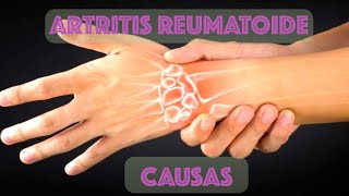 Fisiopatología de la Artritis Reumatoide [upl. by Cymbre]