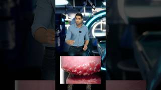 ஆணுறுப்புக்குள் சிறு பருக்களா Pearly penile papules Dr Isacc Abbas [upl. by Hildagarde]