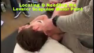 Locating amp Needling the Levator Scapulae Motor Point [upl. by Yelnek]