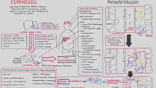 Liver Cirrhosis SandS Pathophysiology Investigations Management [upl. by Fitts]