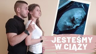 👶 KOCHANIE ZOSTANIESZ TATĄ ❤️ reakcja męża na ciążę 👶 jestem w ciąży [upl. by Lareine123]