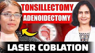 Laser Coblation Tonsillectomy and Adenoidectomy [upl. by Leber]