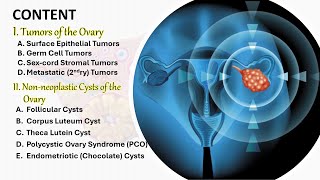 Female genital tumors part3 Ovary tumors and nonneoplastic cysts شرح محاضرة [upl. by Niwde]