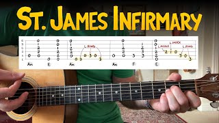 St James Infirmary — Acoustic Blues Guitar Lesson Key of A minor [upl. by Rizzi609]