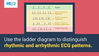 Distinguishing between regular and irregular abnormalities [upl. by Ateiram]