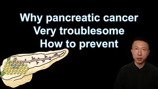 Understanding Pancreatic Cancer Symptoms Risks and Prevention Tips  Expert Insights [upl. by Nosnevets]