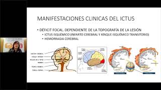 Epidemiología y etiología del Ictus María Alonso de Leciñana [upl. by Gnanmas489]