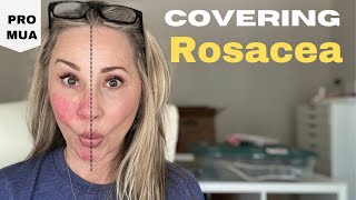 How to Cover Rosacea different methods [upl. by Anilad164]