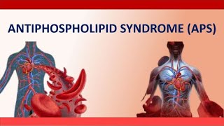 Antiphospholipid Syndrome APS  What Is APS and how to Manage It during Pregnancy [upl. by Solenne5]