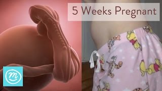 5 Weeks Pregnant What You Need To Know  Channel Mum [upl. by Akiv]