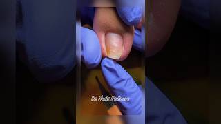 Nails satisfying pedicure shorts nails pedicure satisfying [upl. by Halilak]