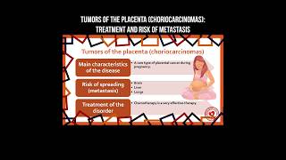 The tumors of placenta choriocarcinoma treatment and risk of metastasis tumor placenta cancer [upl. by Salim]