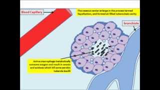 Mycobacterium tuberculosis pathogenesis TB [upl. by Etnor]