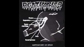 Agathocles  Suppository Of Speed [upl. by Oiraved256]