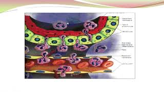 ANATOMIA PATOLÓGICA  NEUMONÍA ATÍPICA  PROF DRA CARMEN COBA [upl. by Dent]