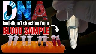 DNA Extraction from Blood Samples Comprehensive StepbyStep Guide  Molecular Biology Laboratory [upl. by Aneerbas258]