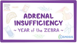 Adrenal insufficiency Year of the Zebra [upl. by Enatan]