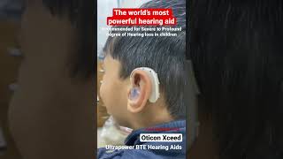 World’s most powerful hearing aid for severe to profound hearing loss in children  Oticon Xceed [upl. by Sioux162]