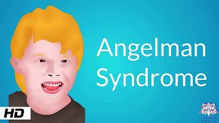 Angelman Syndrome Causes Signs and Symptoms Diagnosis and Treatment [upl. by Ihteerp365]