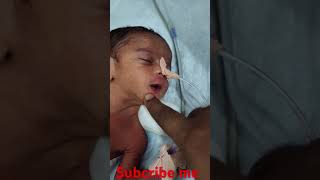 PREMATURE BABY NEWBORN newbornbaby viralshort cute critical [upl. by Nemra]