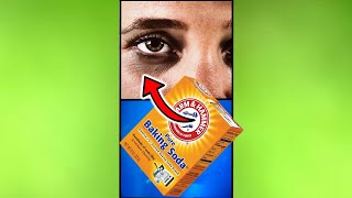 How To Remove Dark Circles And Under Eye Bags With Baking Soda shorts [upl. by Camella59]