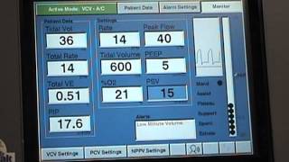 Respironics Esprit Ventilator with Blom Tracheostomy Tube [upl. by Anehta933]