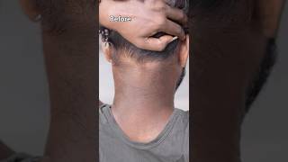 Remove Neck Darkness At Home In 5min  Neck Cleaning Tips  Dark Neck Remove Home Remedies shorts [upl. by Brod]