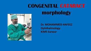 CONGENITAL CATARACTmorphology IMAGE based class [upl. by Amye655]