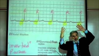 CARDIAC PHYSIOLOGY PART 3 by Professor Finkwmv [upl. by Girand]