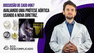 EcoDescomplicado  Discussão de caso 067  Avaliando uma prótese aórtica usando a nova diretriz [upl. by Aikan]