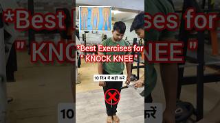 Correct Knock Knees in 10 Days4 Effective Exercises To Cure Knock Knees Forever Correctknockknees [upl. by Eissolf]