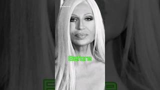 Donatella Versace Before and Afterversace donatellaversaceitaly [upl. by Oremo488]