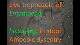 Entamoeba histolytica trophozoite in stool [upl. by Thursby]