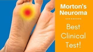 Mortons Neuroma Best Clinical Test [upl. by Annahoj]